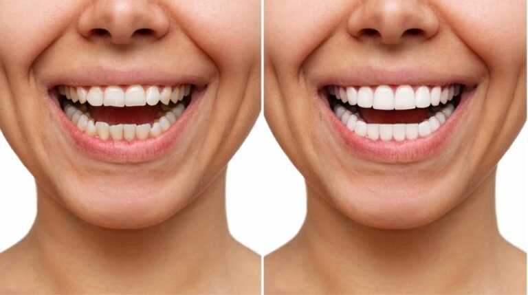 Cosmetic Dentistry Houston TX: Trends Patients Should Be Careful About