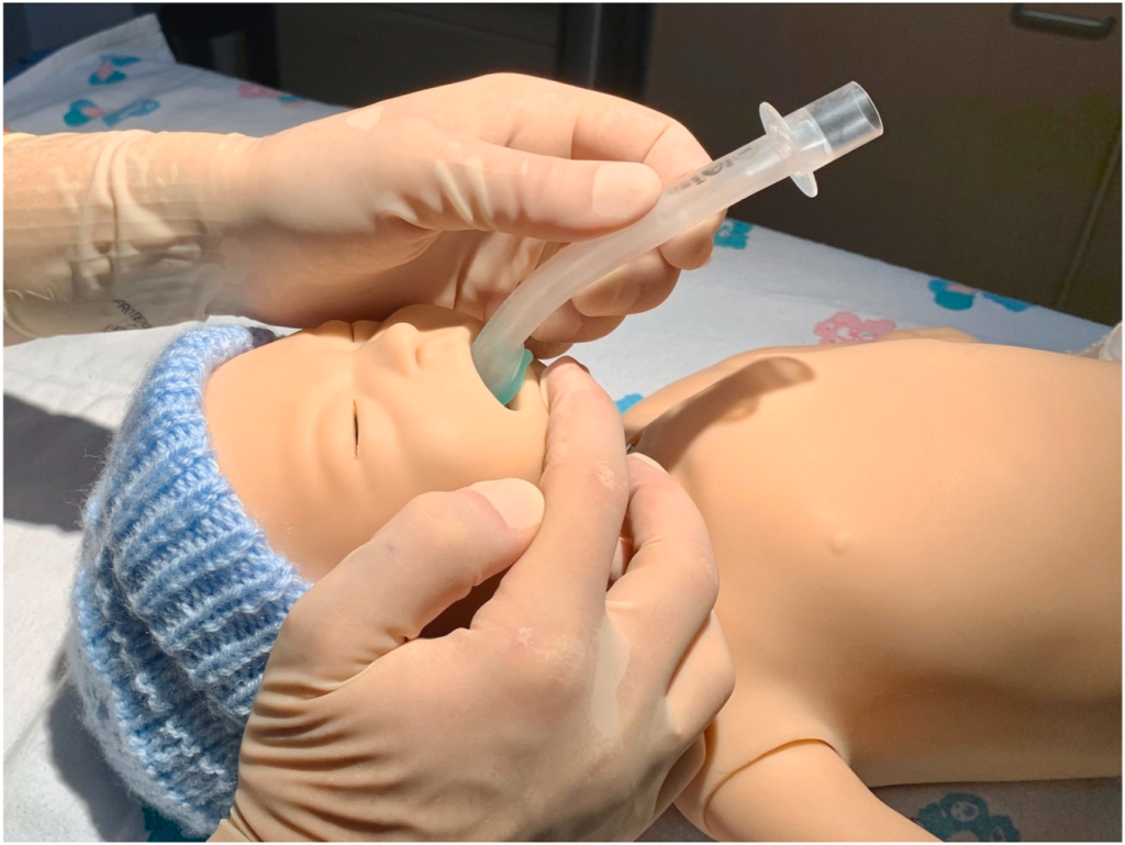 Understanding Neonatal Airway Challenges From a Clinician’s View